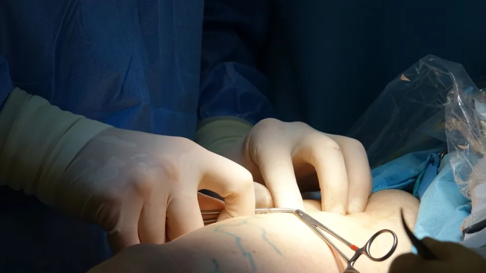 Blood vessel surgery