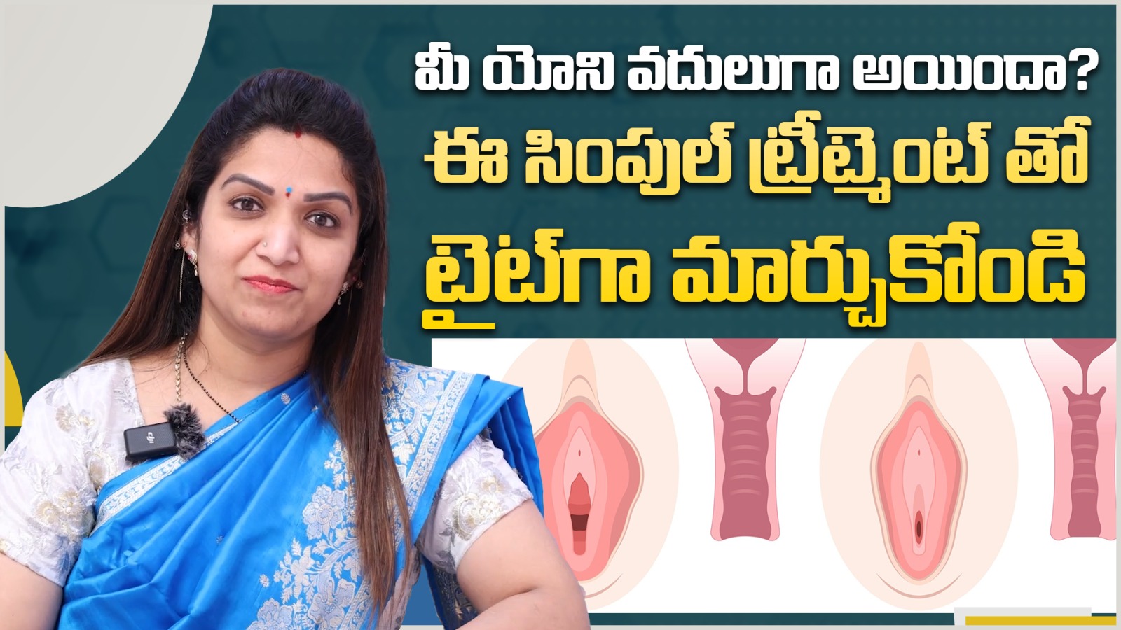 యోని టైట్ అవ్వాలంటే || Non Surgical Vaginal Tightening Treatment in Telugu || Dr Spandana Nalagandla