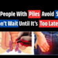 Why Do People With Piles Sprouts Avoid Surgery Dont Wait Until Its Too Late  85x85