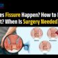 Why Do People With Piles Sprouts Avoid Surgery Dont Wait Until Its Too Late 1 1 85x85